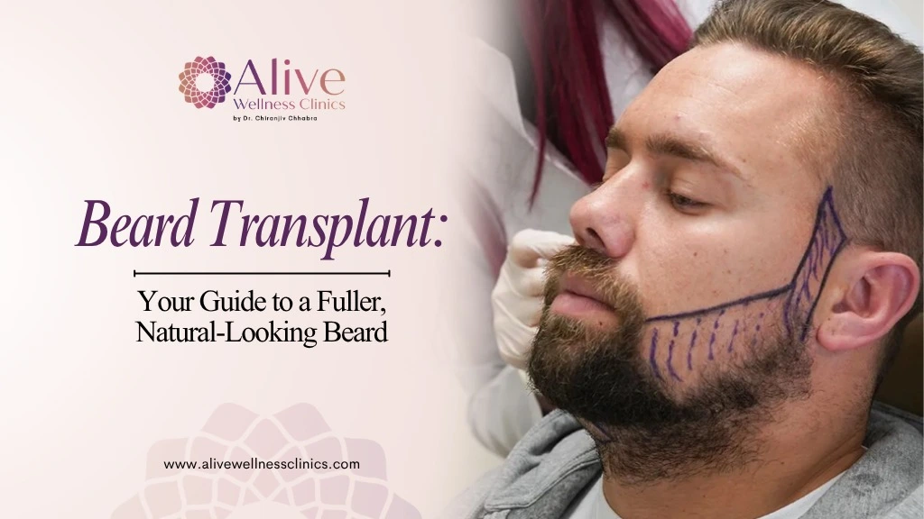 Beard Transplant: Your Guide to a Fuller, Natural-Looking Beard