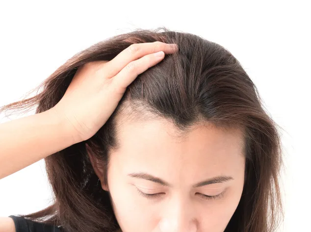 Hair Loss Treatment