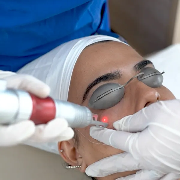 Intense Clarity Laser